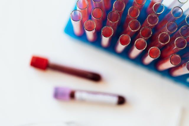 Фото: Karolina Kaboompics: https://www.pexels.com/ru-ru/photo/4226902/